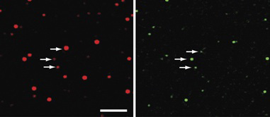 Confocal microscopy images. Right: Brain-lipid vesicles. Smaller ?dots? indicate smaller vesicles. Left: BAR domain protein. The intensity of the dot indicates the amount of BAR bound to the vesicle. The smaller the vesicle, the more curved membrane, and the more binding of BAR. 